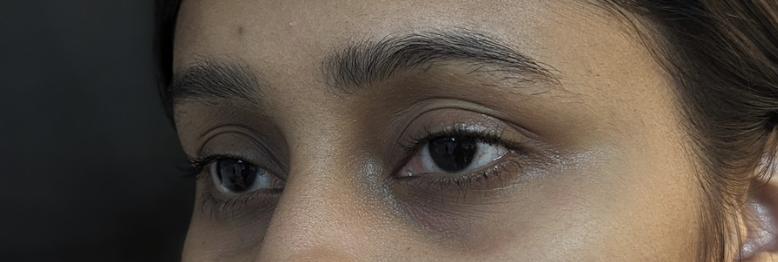 Patient 1 — before