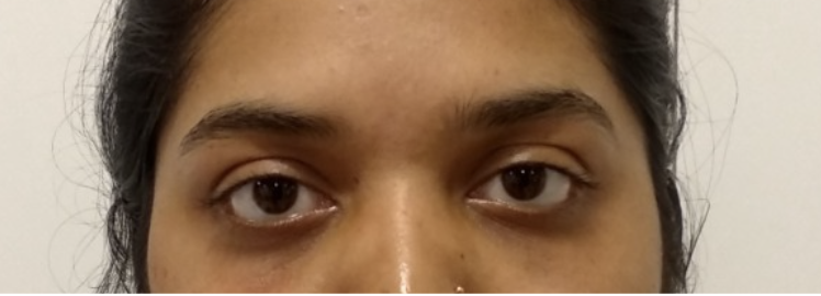 Patient 2 — after