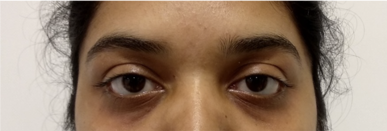 Patient 2 — before