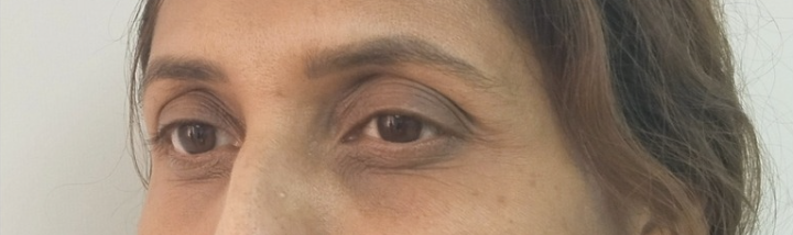 Patient 3 — after