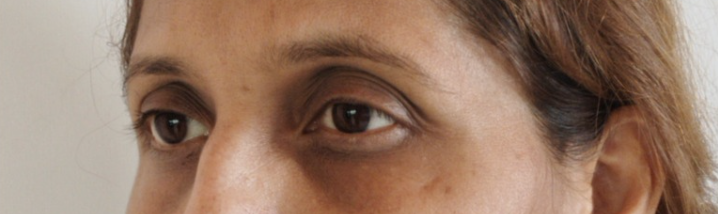 Patient 3 — before