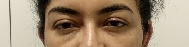 Patient 4 — before