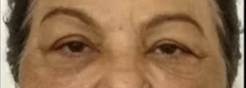 Patient 5 — after
