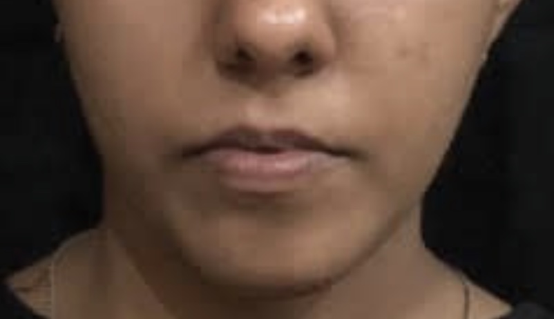 Patient 2 — before