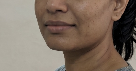 Patient 5 — after