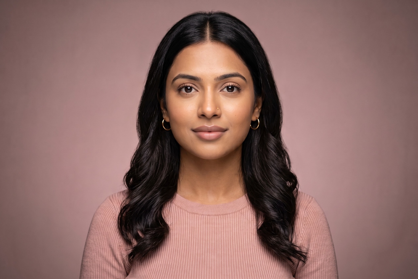 Lip filler — after: fuller, balanced, natural shape
