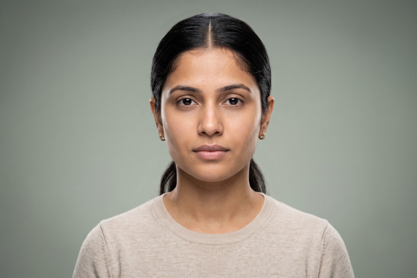 Whole-face harmonisation — after: rested, balanced, put together