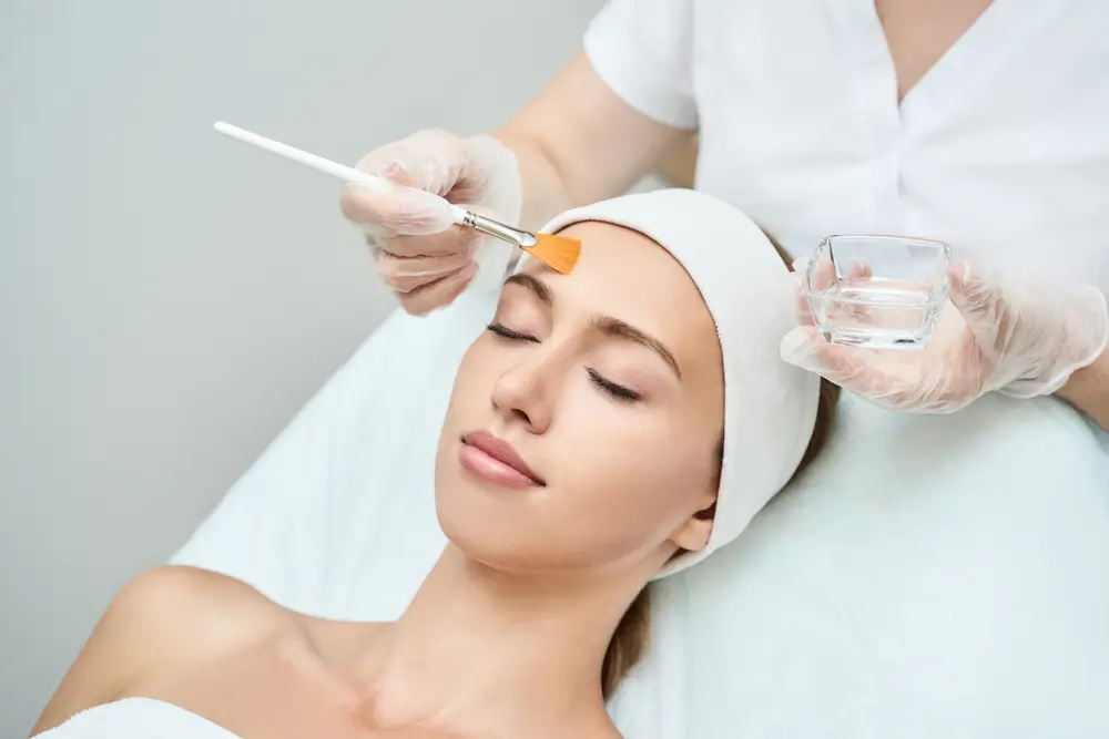 Medical chemical peel being applied at Clinic Next Face